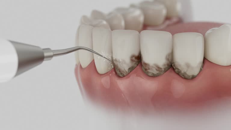 Trusted Emergency Dentist service in Burnsville, NC - Dentist Open Now